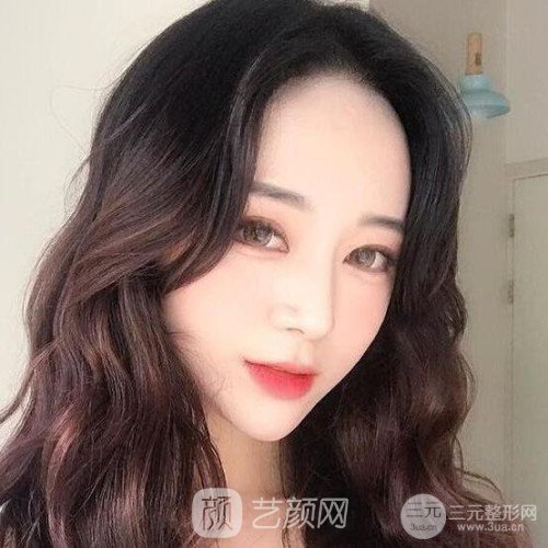 上海華美楊亞益主任做的芭比雙眼皮，果很好哦~